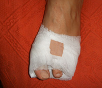 fussverband